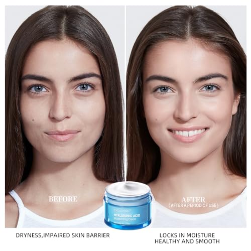 Hyaluronic Acid Moisturizing Water Gel, 1.76 Oz B334