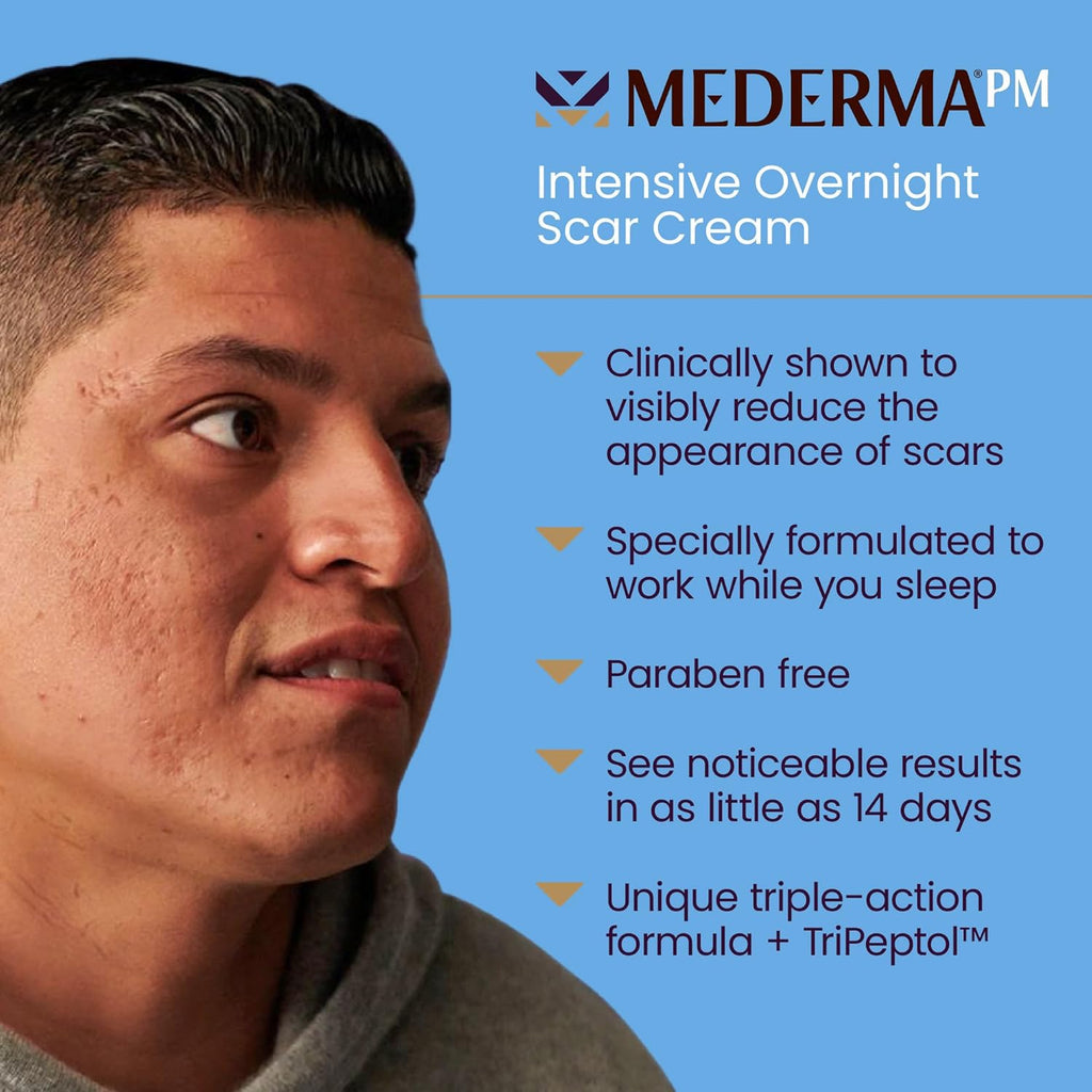 1.7 Oz Scar Cream R55520