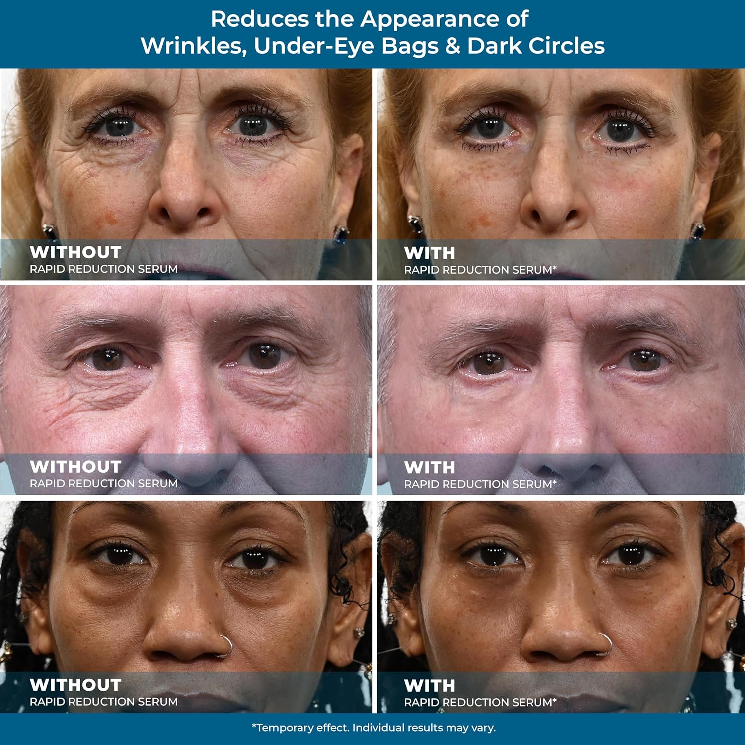 Rapid Reduction Eye Serum N29171