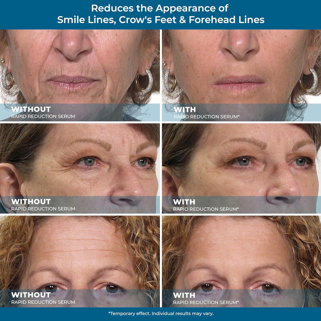 Rapid Reduction Eye Serum N29171