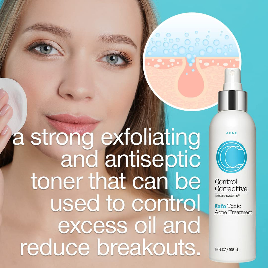 6.7 Fl Oz Exfoliating Acne Treatment Toner P815317